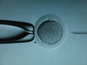 Intracytoplasmic sperm injection (ICSI)