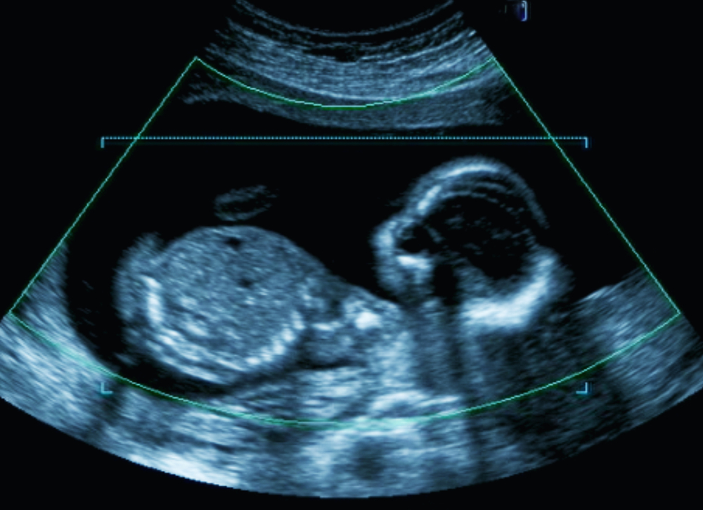 La detección precoz de valores séricos de progesterona, clave en la transferencia de embriones congelados