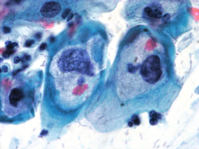 The Catalan Society of Cytopathology strengthens the quality control of cytological analyses