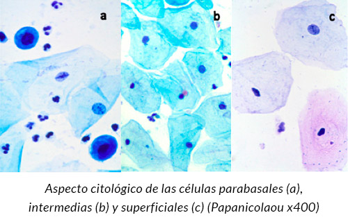 Aspecto citológico células (Papanicolaou)
