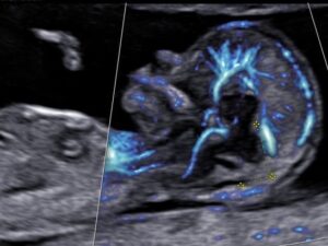 Ecografía fetal paso a paso: Domina la morfología y el crecimiento