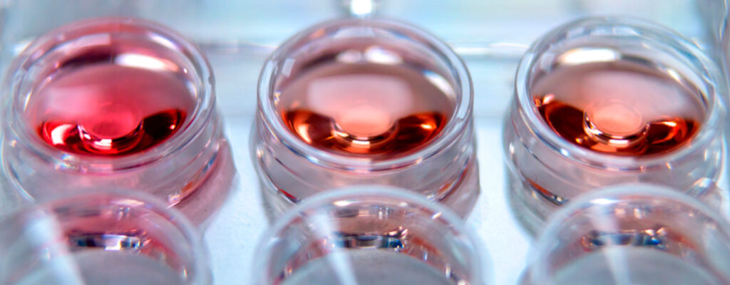 El “dual trigger” no aporta mejores resultados que el uso exclusivo de GnRH-a en preservación electiva