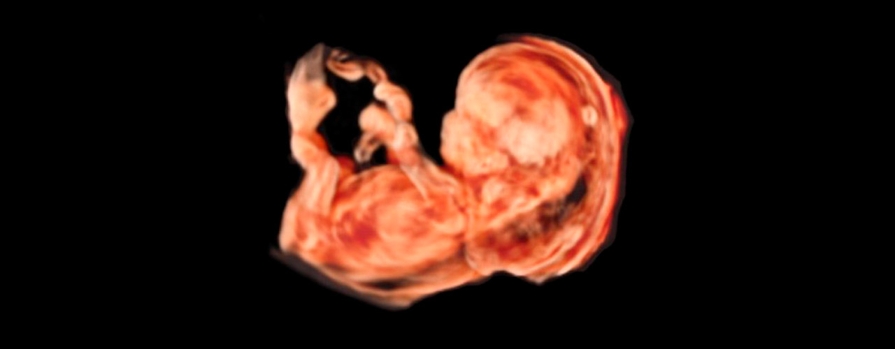 La Fundación Dexeus Mujer premia al Prof. Kypros Nicolaides, pionero mundial de la Medicina fetal